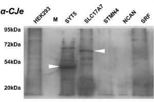 Western blot analysis of the cross-reactivity of antibodies directed against Campylobacter jejuni with different protein samples as provided by commercial HEK-293 overexpression lysates. (Campylobacter jejuni Antikörper)
