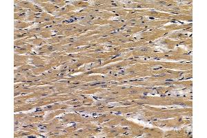 ABIN7095188 and ABIN7099244 at 1/100 staining rat heart tissue by IHC-P. (CLIC5 Antikörper)
