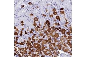 Immunohistochemical staining of human stomach with ZNF442 polyclonal antibody  shows strong cytoplasmic positivity in cells of tubules at 1:50-1:200 dilution.