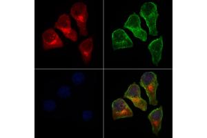 ABIN6263378 and ABIN6279009 staining HepG2 cells by IF/ICC. (MRPS15 Antikörper  (Internal Region))
