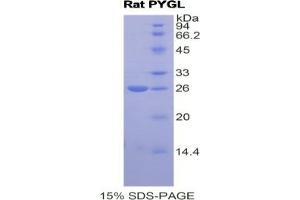 SDS-PAGE analysis of Rat PYGL Protein. (PYGL Protein)
