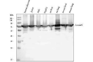 Western blot analysis of Annexin VI/ANXA6 using anti-Annexin VI/ANXA6 antibody (ABIN5692982). (ANXA6 Antikörper  (AA 395-665))