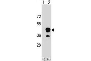 Western blot analysis of CD1b antibody and 293 cell lysate (2 ug/lane) either nontransfected (Lane 1) or transiently transfected (2) with the CD1B gene. (CD1b Antikörper  (AA 57-85))
