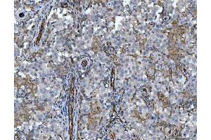 IHC analysis of STBD1 using anti-STBD1 antibody (ABIN7601576). (STBD1 Antikörper  (AA 39-328))