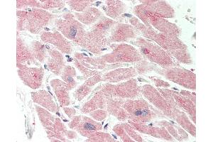 Immunohistochemistry (IHC) image for anti-Activin A Receptor, Type IIB (ACVR2B) (AA 323-372) antibody (ABIN6755435)