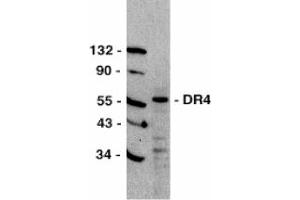 Image no. 1 for anti-Tumor Necrosis Factor Receptor Superfamily, Member 10a (TNFRSF10A) (C-Term) antibody (ABIN201644) (TNFRSF10A Antikörper  (C-Term))