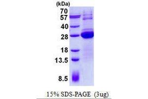 Figure annotation denotes ug of protein loaded and % gel used. (LSM12B Protein)