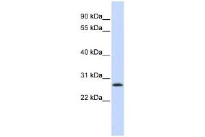 WB Suggested Anti-LSM12 Antibody Titration: 0.