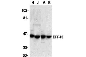Western Blotting (WB) image for anti-DNA Fragmentation Factor, 45kDa, alpha Polypeptide (DFFA) (C-Term) antibody (ABIN1030360) (DFFA Antikörper  (C-Term))