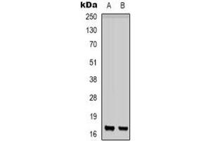 Western blot analysis of CD225 expression in K562 (A), PC12 (B) whole cell lysates. (IFITM1 Antikörper  (N-Term))