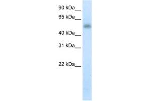 Western Blotting (WB) image for anti-Methyltransferase Like 3 (METTL3) antibody (ABIN2461900) (METTL3 Antikörper)