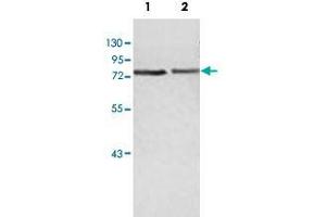 Western blot analysis of human fetal heart (Lane 1) and fetal brain (Lane 2) lysate with ZBED5 polyclonal antibody  at 1 : 500 dilution. (ZBED5 Antikörper  (AA 224-474))