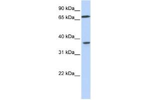 WB Suggested Anti-MAP2K3 Antibody Titration:  0. (MAP2K3 Antikörper  (C-Term))
