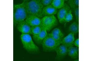 IF analysis of Krt20 using anti-Krt20 antibody (ABIN7601133). (KRT20 Antikörper  (AA 29-431))