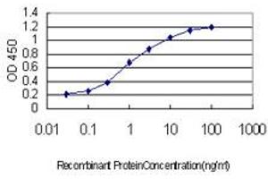 Detection limit for recombinant GST tagged CHD4 is approximately 0. (CHD4 Antikörper  (AA 1632-1730))