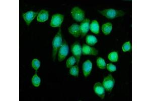 IF analysis of KIF2A using anti-KIF2A antibody (ABIN7600510). (KIF2A Antikörper  (AA 2-706))