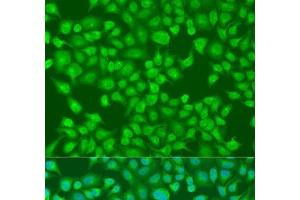 Immunofluorescence analysis of U2OS cells using ACOX1 Polyclonal Antibody at dilution of 1:100. (ACOX1 Antikörper)