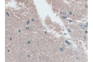 Immunohistochemistry (IHC) image for anti-NLR Family, Pyrin Domain Containing 3 (NLRP3) (AA 671-1033) antibody (ABIN7443710)
