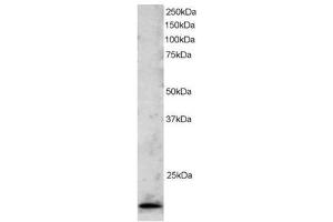 Image no. 1 for anti-Telomeric Repeat Binding Factor 2 (TERF2) (C-Term) antibody (ABIN374265) (TRF2 Antikörper  (C-Term))