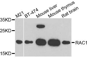 Western blot analysis of extracts of various cell lines, using RAC1 antibody. (RAC1 Antikörper)