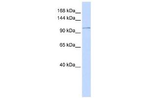 ATP2B3 antibody used at 1 ug/ml to detect target protein. (ATP2B3 Antikörper  (N-Term))