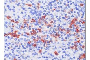 Image no. 1 for anti-S100 Calcium Binding Protein A8 (S100A8) antibody (ABIN379948) (S100A8 Antikörper)
