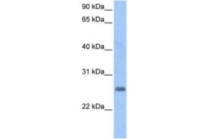 Western Blotting (WB) image for anti-Zinc Finger Protein Pseudogene (LOC728743) antibody (ABIN2463386) (LOC728743 Antikörper)
