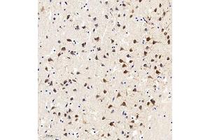 Immunohistochemistry of paraffin embedded mouse brain using MAP9 (ABIN7074622) at dilution of 1:750 (300x lens) (MAP9 Antikörper)