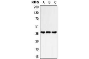 Western blot analysis of GPR25 expression in HeLa (A), NIH3T3 (B), rat spleen (C) whole cell lysates.