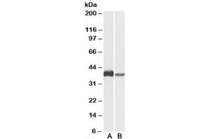 Western blot testing of U937 [A] and human spleen [B] lysates with CAPG antibody at 0. (CAPG Antikörper)