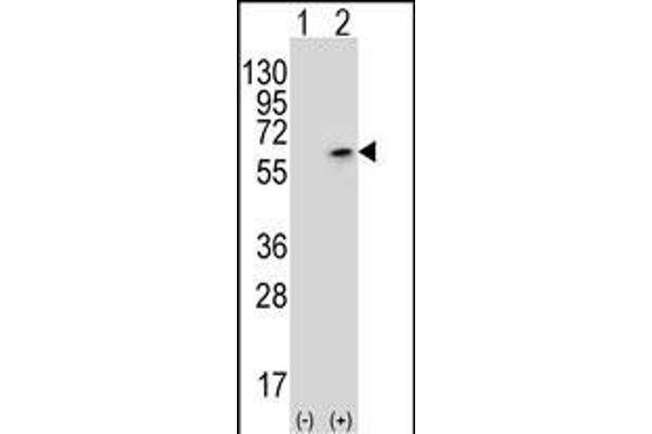 CDK18 Antikörper  (N-Term)