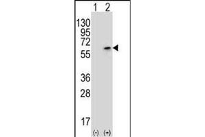 Western blot analysis of PCTK3 (arrow) using rabbit polyclonal PCTK3 Antibody (N40) (ABIN391790 and ABIN2841646). (CDK18 Antikörper  (N-Term))