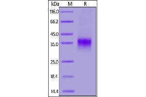 Biotinylated Mouse CD28, His,Avitag on  under reducing (R) condition.