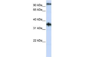 WB Suggested Anti-C9orf4 Antibody Titration:  0. (Ferric-Chelate Reductase 1 Like (FRRS1L) (N-Term) Antikörper)
