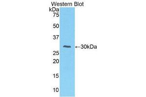 Western Blotting (WB) image for anti-Interleukin-1 Receptor-Associated Kinase 2 (IRAK2) (AA 211-458) antibody (ABIN3206500)