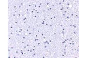 Immunohistochemistry (IHC) image for anti-Anaphase Promoting Complex Subunit 1 (ANAPC1) (C-Term) antibody (ABIN1030243) (APC1 Antikörper  (C-Term))