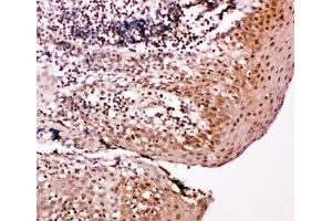 IHC-P: Caspase-14 antibody testing of human tonsil tissue