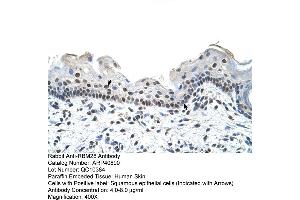Rabbit Anti-RBM28 Antibody  Paraffin Embedded Tissue: Human Skin Cellular Data: Squamous epithelial cells Antibody Concentration: 4. (RBM28 Antikörper  (C-Term))