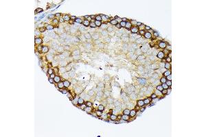Immunohistochemistry of paraffin-embedded rat testis using USP9X Rabbit mAb (ABIN7271169) at dilution of 1:100 (40x lens). (USP9X Antikörper)
