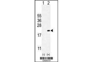 Western blot analysis of CDKN2C using rabbit polyclonal CDKN2C Antibody using 293 cell lysates (2 ug/lane) either nontransfected (Lane 1) or transiently transfected (Lane 2) with the CDKN2C gene. (CDKN2C Antikörper  (C-Term))