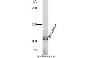 Mouse breast cancer lysates probed with Anti-N-cadherin Polyclonal Antibody, Unconjugated  at 1:5000 90min in 37˚C.