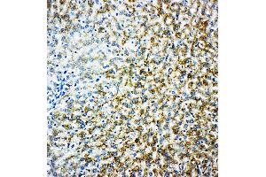 Anti-Monoamine Oxidase B antibody, IHC(P) IHC(P): Rat Liver Tissue (Monoamine Oxidase B Antikörper  (N-Term))