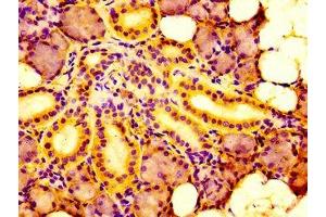 Immunohistochemistry (IHC) image for anti-Interferon Regulatory Factor 2 Binding Protein 1 (IRF2BP1) (AA 340-499) antibody (ABIN7156618)