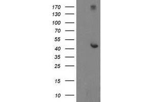 Western Blotting (WB) image for anti-Adaptor-Related Protein Complex 2, mu 1 Subunit (AP2M1) (AA 97-383) antibody (ABIN1491719) (AP2M1 Antikörper  (AA 97-383))