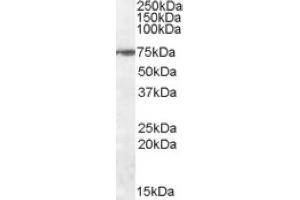 Image no. 1 for anti-Zinc Finger Protein 803 (ZNF803) (Internal Region) antibody (ABIN375091) (WIZ Antikörper  (Internal Region))