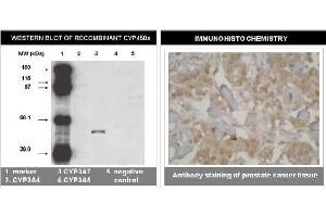 Immunohistochemistry (IHC) image for anti-Cytochrome P450, Family 3, Subfamily A, Polypeptide 7 (CYP3A7) (C-Term) antibody (ABIN264501) (CYP3A7 Antikörper  (C-Term))