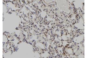ABIN6272516 at 1/100 staining Rat lung tissue by IHC-P. (MAGED2 Antikörper  (N-Term))