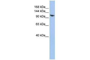 WB Suggested Anti-RNF20 Antibody Titration:  0. (RNF20 Antikörper  (N-Term))