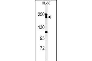 Western blot analysis of BLM Antibody (C-term) (ABIN651053 and ABIN2840049) in HL-60 cell line lysates (35 μg/lane). (BLM Antikörper  (C-Term))