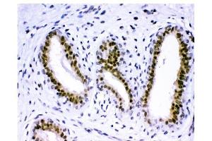 IHC analysis of KDM5B using anti-KDM5B antibody (ABIN4886648). (KDM5B Antikörper  (Middle Region))